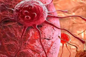 10 Najlepszych faktów poznawczych o komórkach nowotworowych 10 Najlepszych faktów poznawczych o komórkach nowotworowych